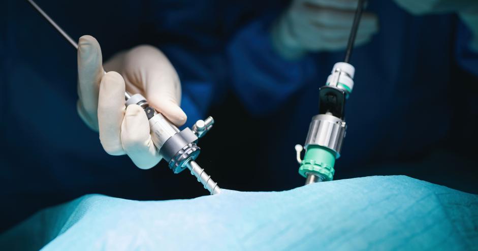 Minimaliai invazyvi chirurgija – laparoskopinės operacijos