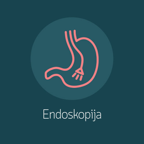 Endoskopija