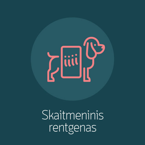 Skaitmeninis rentgenas